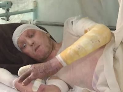 Mykolaiv Hospitals Are Full of Civilians And Military Servicemen Injured by the Russian Invaders