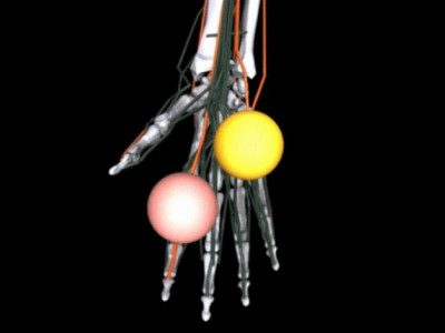 Meta's AI will help doctors develop better prosthetics