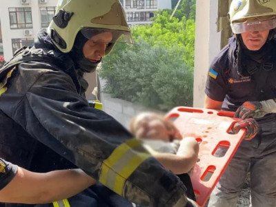Missile Attack On Kyiv. 7-Year-Old Girl Pulled Out From Rubble Had Surgery