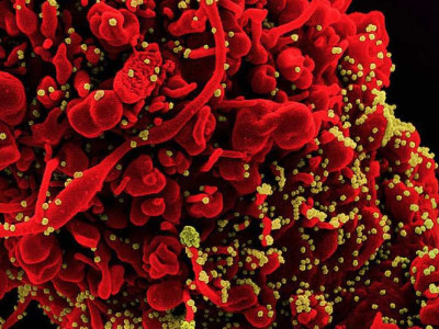 COVID-19 was third leading cause of death in the United States in both 2020 and 2021