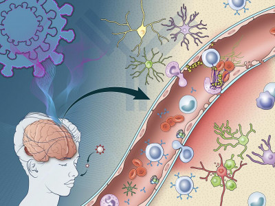 SARS-CoV-2 infection can damage cells lining blood vessels in the brain