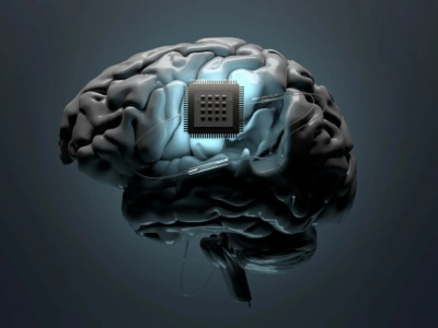 Synchron: The First Chip Implanted Into a Human Brain