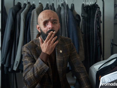 Losing an eye, an arm or a leg is a small death. The story of