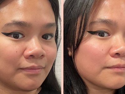 Is Emface a Needle-Free Alternative to Botox and Filler? I Tried It