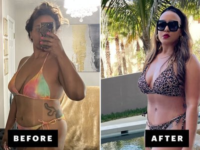 Finally, a Liposuction & Tummy Tuck Story From a Black Plastic-Surgery Patient
