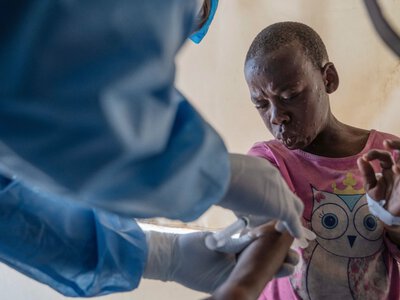 Africa CDC warns of rising mpox cases as death toll reaches 643