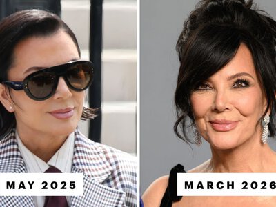 Kris Jenner’s Facelift Is Apparently Now “Slipping”