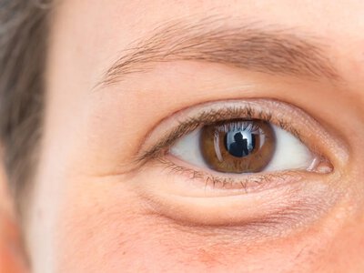 Why facial swelling occurs and how to restore a fresh look without extra effort