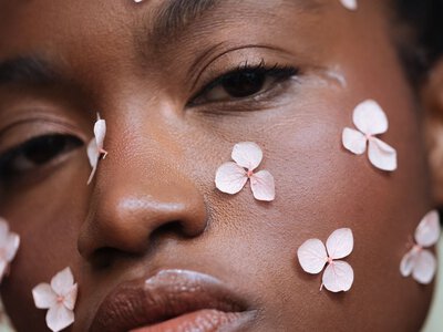 Why Your Skin Freaks Out When the Seasons Change