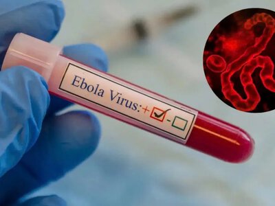 Congo requests experimental Ebola treatment after number of infected exceeds 1,000