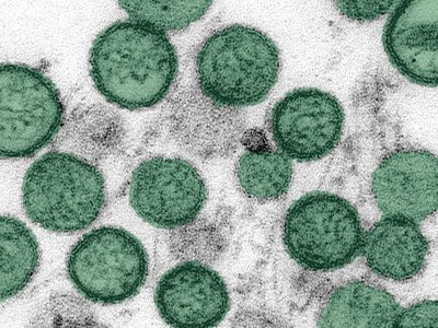 WHO announces timeline for end of hantavirus outbreak