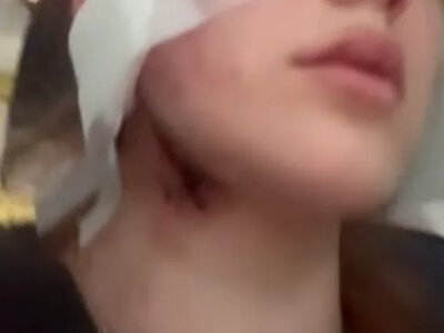 The Consulate General of Ukraine in Wrocław responded to reports of an attack on Ukrainians and appealed to the Polish police