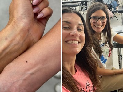 Why My Fine-Line Tattoo Fell Off a Week After I Got It