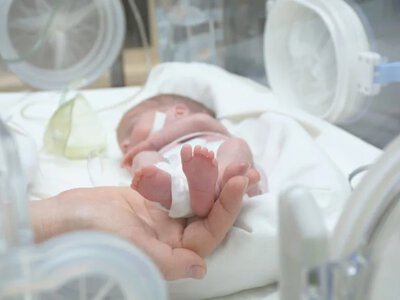 From 22 weeks: how premature babies are cared for