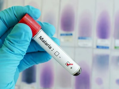 Frankfurt reports a third malaria death; outbreak linked to the airport