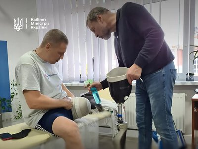 Prosthetics under the state program: The Cabinet is changing the conditions for complex cases