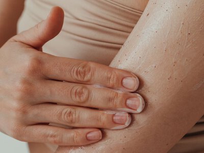 10 Beauty Products and Treatments That Can Trigger a Psoriasis Flare