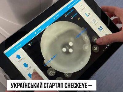 Ukrainian startup CheckEye takes second place in international medical innovation competition